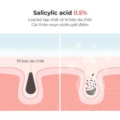 Cosrx Salicylic Acid Daily Gentle Cleanser loại bỏ tế bào chết