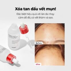 Xóa tan vết thâm mụn Cosrx Blemish Spot Clearing Serum